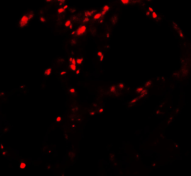 BAMBI Antibody in Immunohistochemistry (Paraffin) (IHC (P))