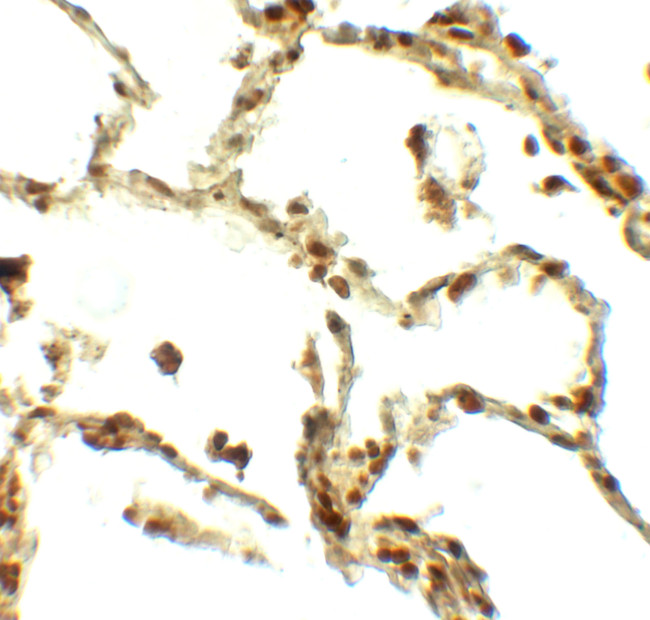 BAMBI Antibody in Immunohistochemistry (Paraffin) (IHC (P))