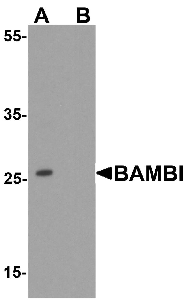BAMBI Antibody in Western Blot (WB)