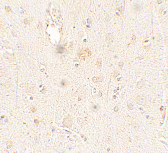 ULK3 Antibody in Immunohistochemistry (Paraffin) (IHC (P))