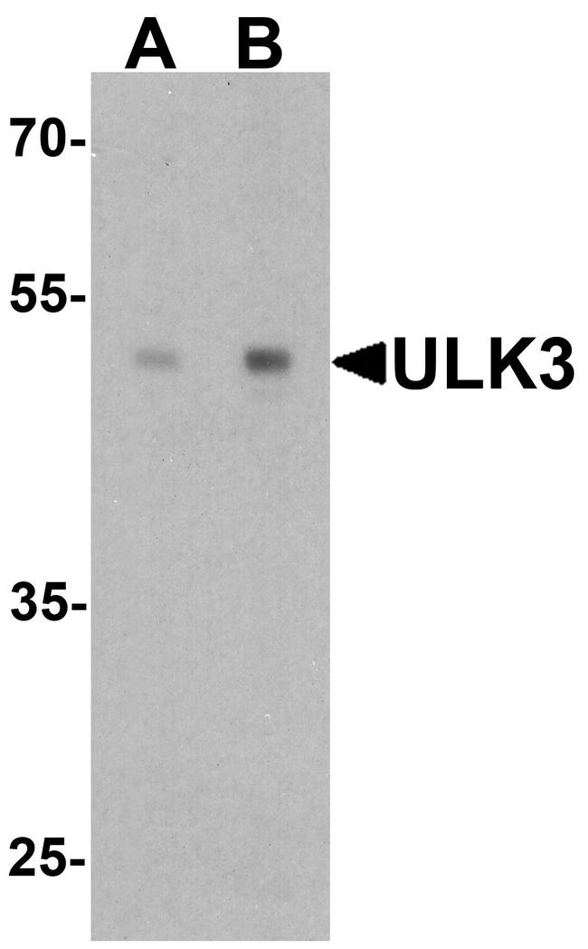 ULK3 Antibody in Western Blot (WB)