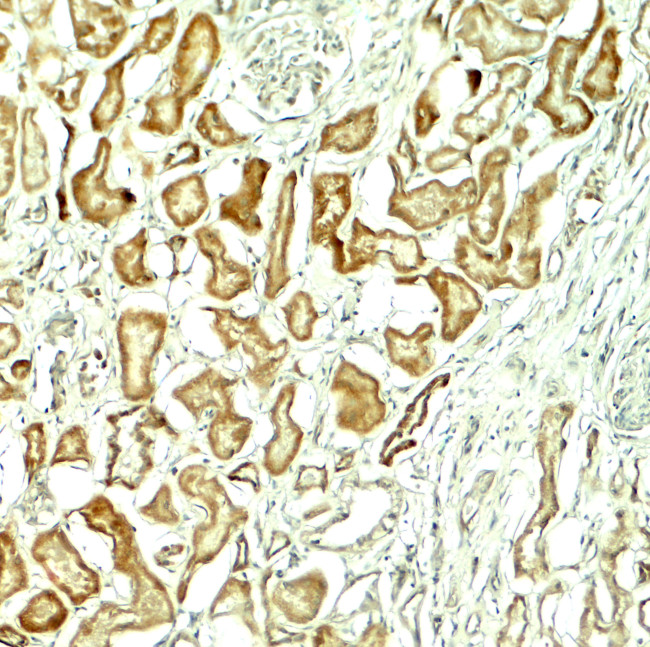 NOX1 Antibody in Immunohistochemistry (Paraffin) (IHC (P))