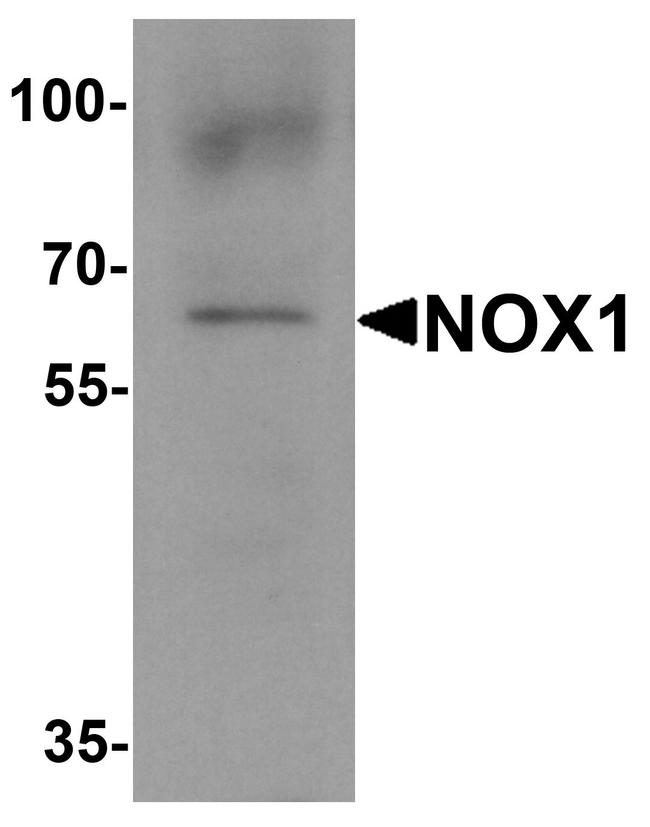 NOX1 Antibody in Western Blot (WB)