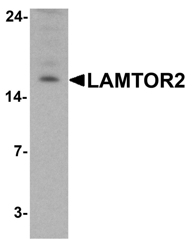 LAMTOR2 Antibody in Western Blot (WB)