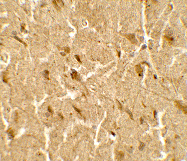 USP25 Antibody in Immunohistochemistry (Paraffin) (IHC (P))