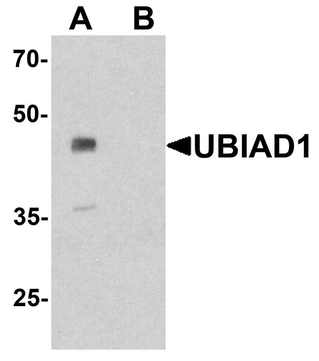 UBIAD1 Antibody in Western Blot (WB)