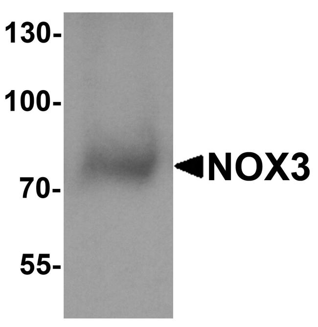 NOX3 Antibody in Western Blot (WB)