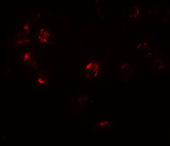 ZNF821 Antibody in Immunocytochemistry (ICC/IF)