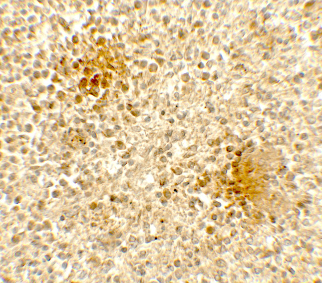 DOCK8 Antibody in Immunohistochemistry (Paraffin) (IHC (P))