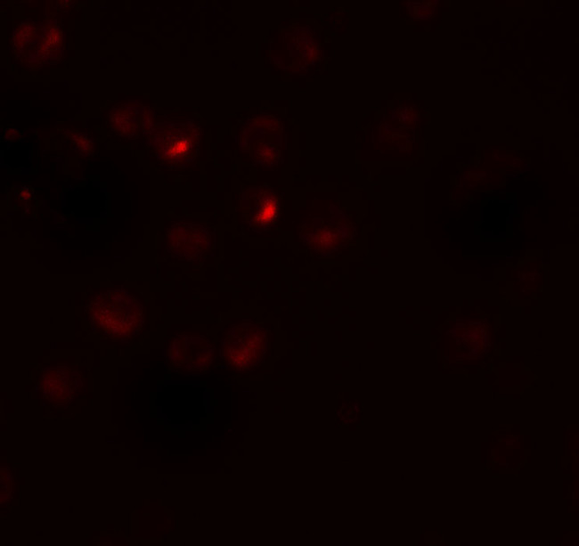 RSPO3 Antibody in Immunocytochemistry (ICC/IF)