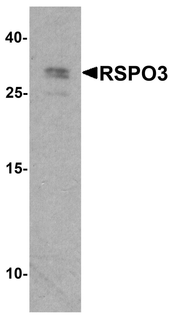 RSPO3 Antibody in Western Blot (WB)