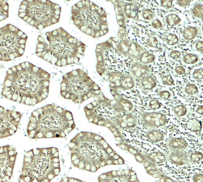 CTHRC1 Antibody in Immunohistochemistry (Paraffin) (IHC (P))