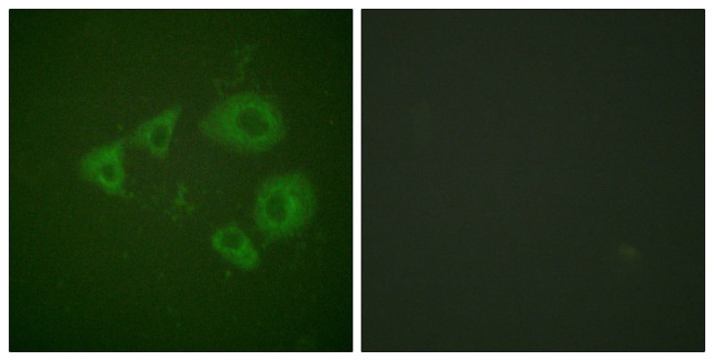 Phospho-TrkB (Tyr705) Antibody in Immunocytochemistry (ICC/IF)