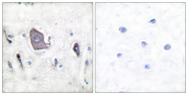 Phospho-TrkB (Tyr705) Antibody in Immunohistochemistry (Paraffin) (IHC (P))