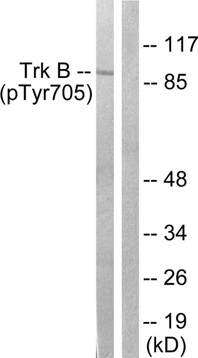 Phospho-TrkB (Tyr705) Antibody in Western Blot (WB)