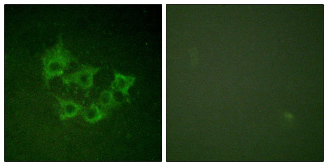 Phospho-TPL2 (Thr290) Antibody in Immunocytochemistry (ICC/IF)