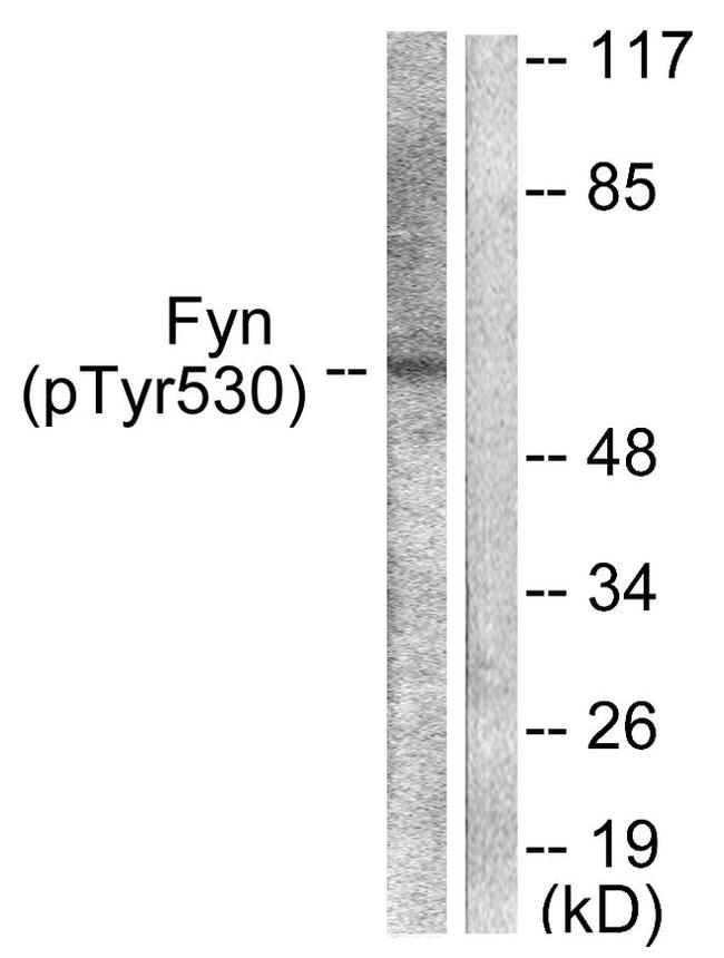 Phospho-Fyn (Tyr530) Antibody in Western Blot (WB)