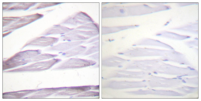 Phospho-IKK alpha/beta (Ser176, Ser177) Antibody in Immunohistochemistry (Paraffin) (IHC (P))