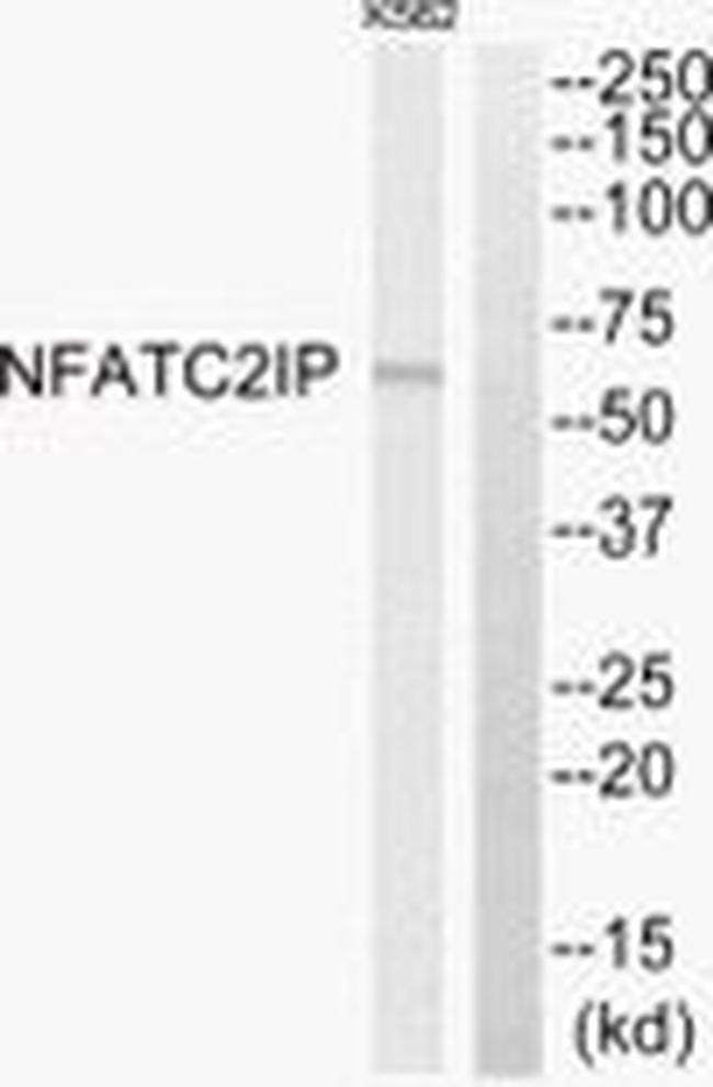 NFATC2IP Antibody in Western Blot (WB)