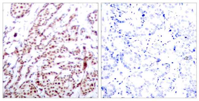 Phospho-ATF2 (Thr55, Thr73) Antibody in Immunohistochemistry (Paraffin) (IHC (P))