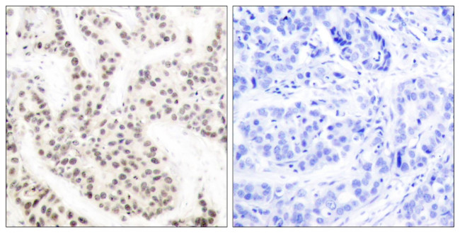 Phospho-ELK1 (Thr417) Antibody in Immunohistochemistry (Paraffin) (IHC (P))