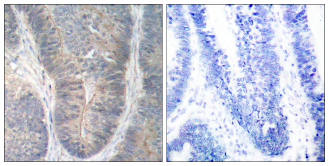 Phospho-PKR (Thr451) Antibody in Immunohistochemistry (Paraffin) (IHC (P))