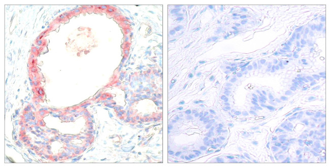 Phospho-c-Rel (Ser503) Antibody in Immunohistochemistry (Paraffin) (IHC (P))