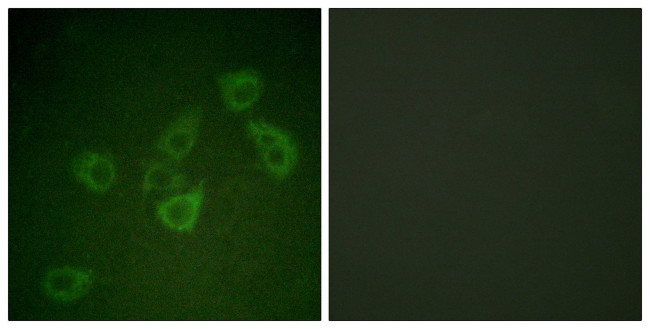 Phospho-Caspase 6 (Ser257) Antibody in Immunocytochemistry (ICC/IF)