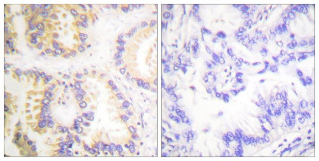 Phospho-Caspase 8 (Ser347) Antibody in Immunohistochemistry (Paraffin) (IHC (P))