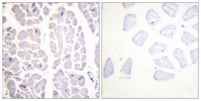 Phospho-IKK alpha/beta (Ser180, Ser181) Antibody in Immunohistochemistry (Paraffin) (IHC (P))