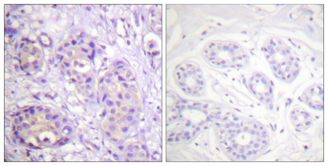 Phospho-IKK beta (Tyr199) Antibody in Immunohistochemistry (Paraffin) (IHC (P))