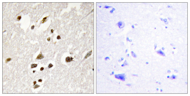 Phospho-IRF3 (Ser385) Antibody in Immunohistochemistry (Paraffin) (IHC (P))