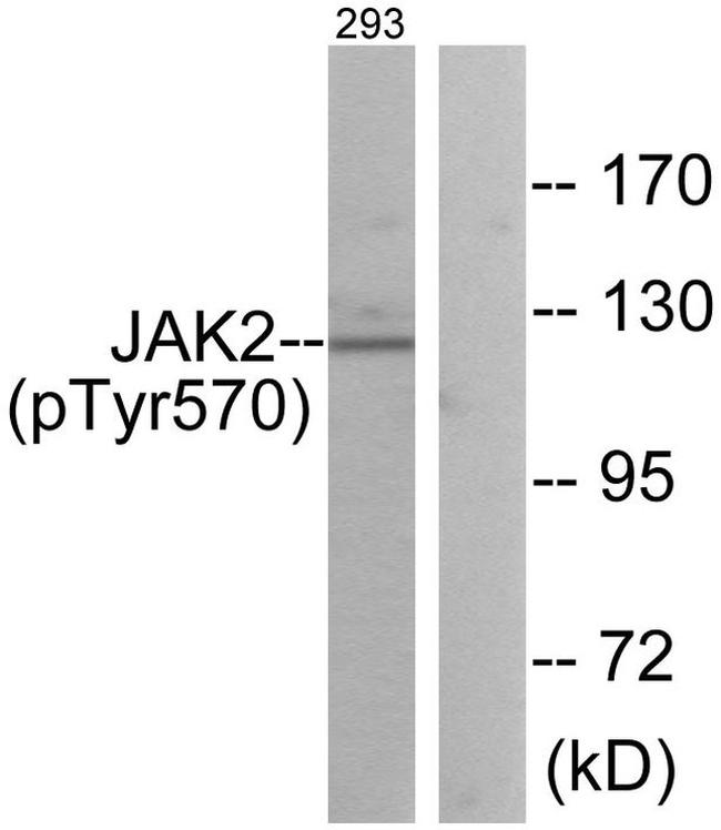 Phospho-JAK2 (Tyr570) Antibody in Western Blot (WB)