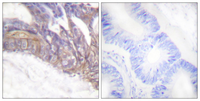 Phospho-LAT (Tyr191) Antibody in Immunohistochemistry (Paraffin) (IHC (P))