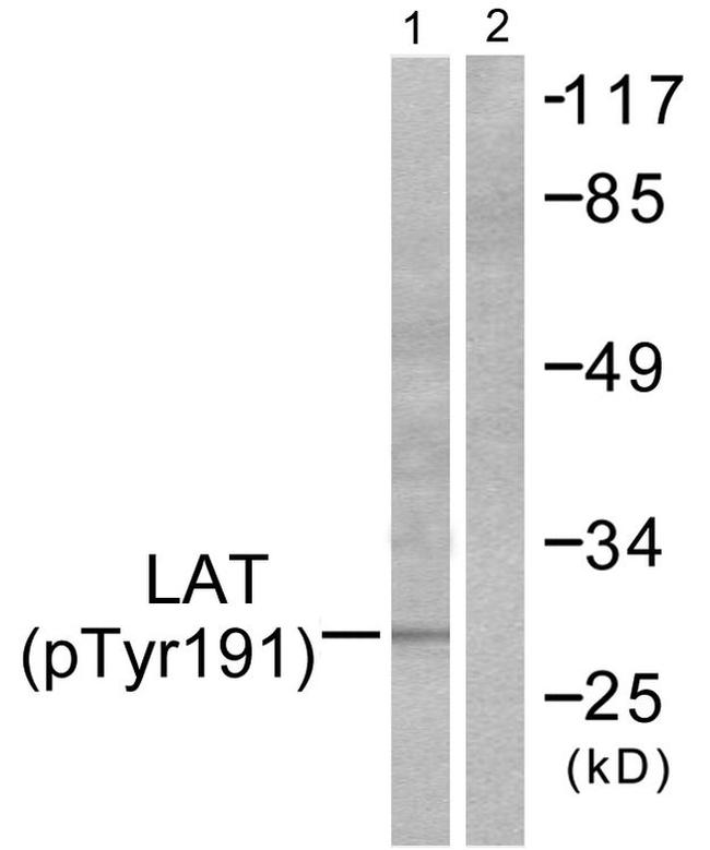 Phospho-LAT (Tyr191) Antibody in Western Blot (WB)