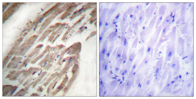 Phospho-NFATC1 (Ser294) Antibody in Immunohistochemistry (Paraffin) (IHC (P))