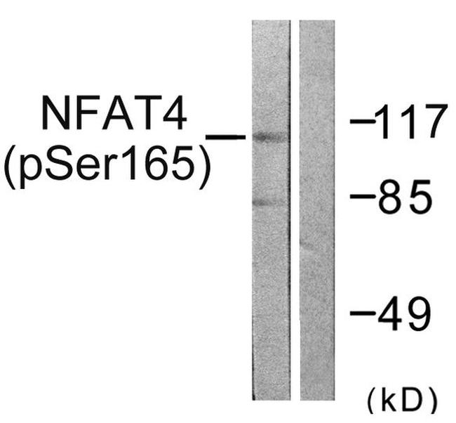 Phospho-NFATC3 (Ser165) Antibody in Western Blot (WB)