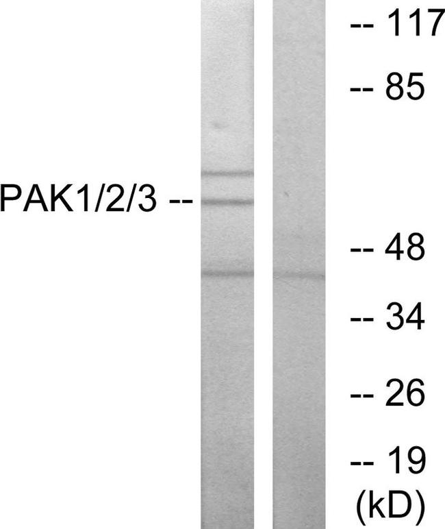 PAK1/2/3 Antibody in Western Blot (WB)