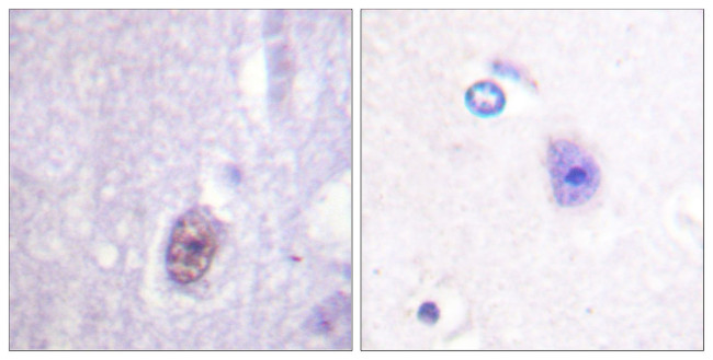 Phospho-SP1 (Thr453) Antibody in Immunohistochemistry (Paraffin) (IHC (P))