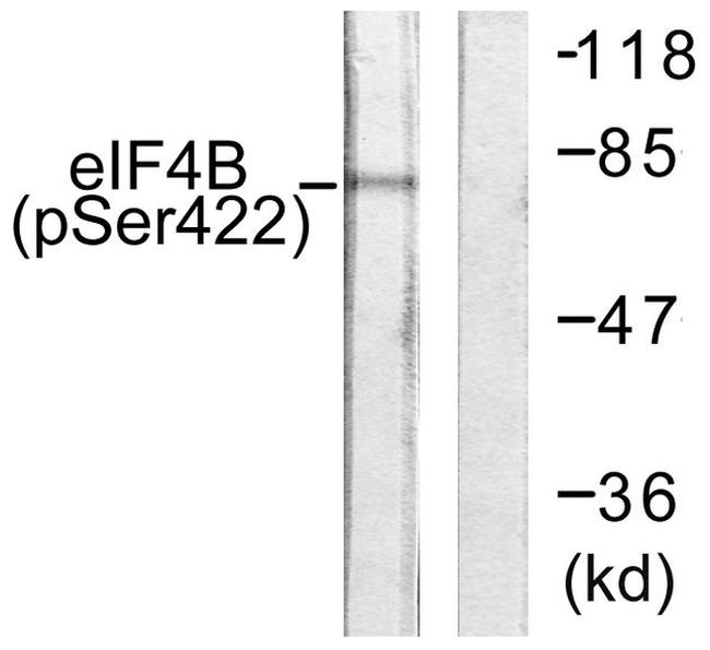 Phospho-eIF4B (Ser422) Antibody in Western Blot (WB)