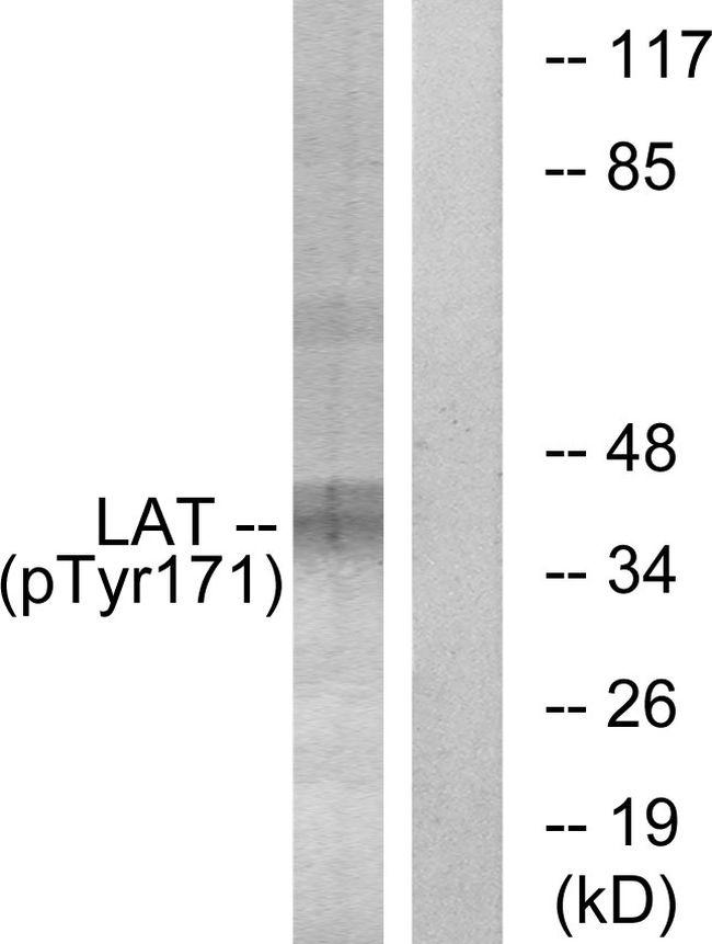 Phospho-LAT (Tyr171) Antibody in Western Blot (WB)