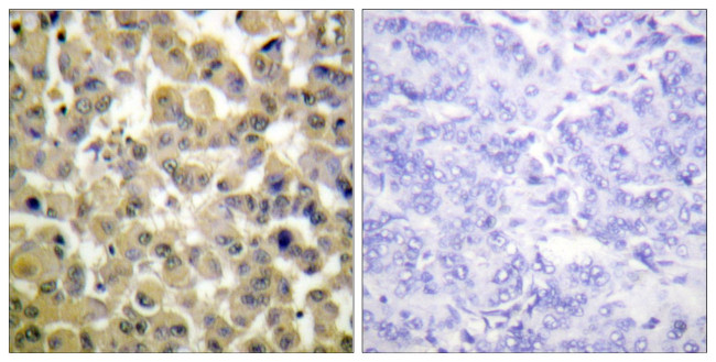 Phospho-MSK1 (Ser360) Antibody in Immunohistochemistry (Paraffin) (IHC (P))