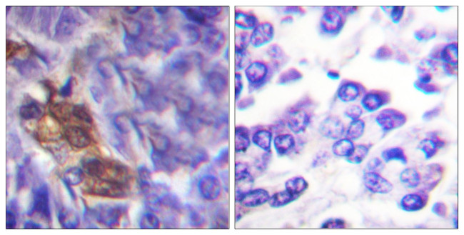 MSK1 Antibody in Immunohistochemistry (Paraffin) (IHC (P))