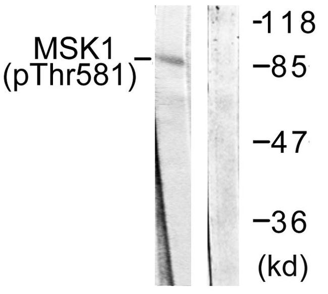 MSK1 Antibody in Western Blot (WB)