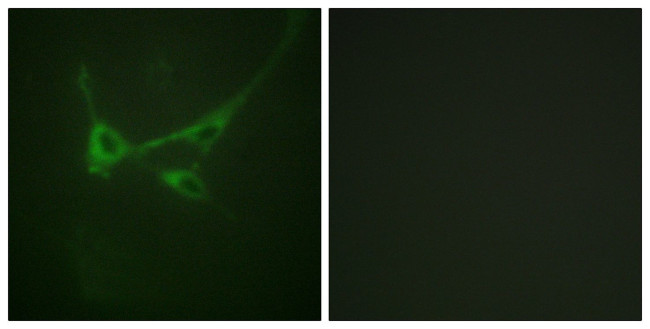 Phospho-mTOR (Ser2481) Antibody in Immunocytochemistry (ICC/IF)