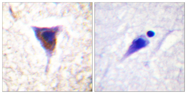 Phospho-mTOR (Ser2481) Antibody in Immunohistochemistry (Paraffin) (IHC (P))