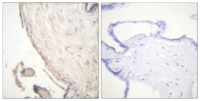 Phospho-B-Raf (Ser602) Antibody in Immunohistochemistry (Paraffin) (IHC (P))