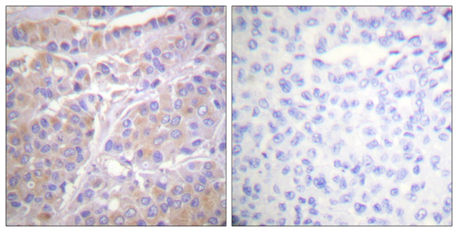 Phospho-GAB1 (Tyr659) Antibody in Immunohistochemistry (Paraffin) (IHC (P))