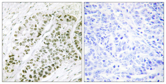 Phospho-ATF2 (Ser480) Antibody in Immunohistochemistry (Paraffin) (IHC (P))