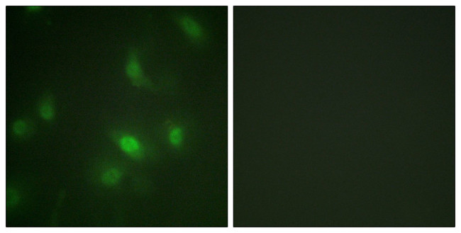Phospho-STAT5 alpha (Ser725) Antibody in Immunocytochemistry (ICC/IF)